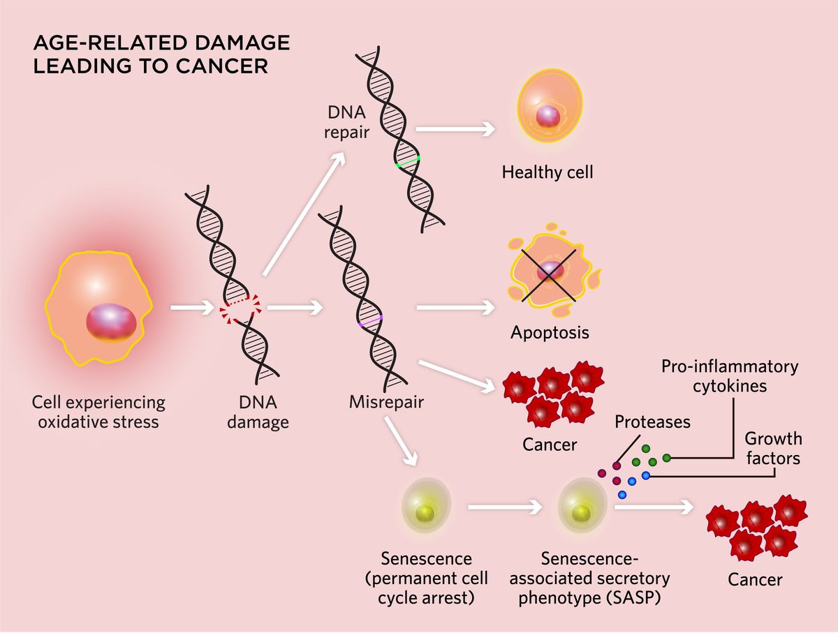 Infographic depicting age-related factors that can lead to cancer. The example centers around a cell experiencing oxidative stress that undergoes DNA damage. If the DNA is misrepaired, the cell can undergo apoptosis, become cancerous, or become senescent. Senescent cells can express the senescence-associated phenotype (SASP), where they secrete substance such as pro-inflammatory cytokines, proteases, and growth factors that can turn cells cancerous. Infographic depicting age-related factors that can lead to cancer. The example centers around a cell experiencing oxidative stress that undergoes DNA damage. If the DNA is misrepaired, the cell can undergo apoptosis, become cancerous, or become senescent. Senescent cells can express the senescence-associated phenotype (SASP), where they secrete substance such as pro-inflammatory cytokines, proteases, and growth factors that can turn cells cancerous.