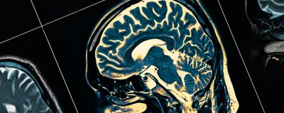 MRI scan of a human head in profile