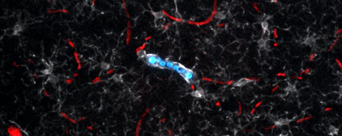 An image of fungi labeled blue inside of a white-labeled microglia, surrounded by red-labeled blood vessels. An image of fungi labeled blue inside of a white-labeled microglia, surrounded by red-labeled blood vessels.