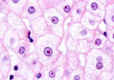 Microscopy image of hepatocytes stained in pink with purple nuclei.