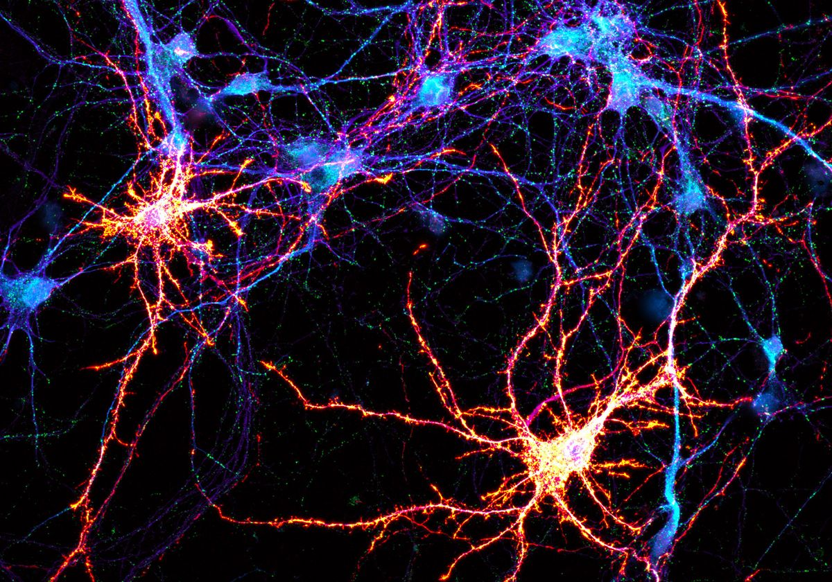 Neurons in culture. Neurons in culture.