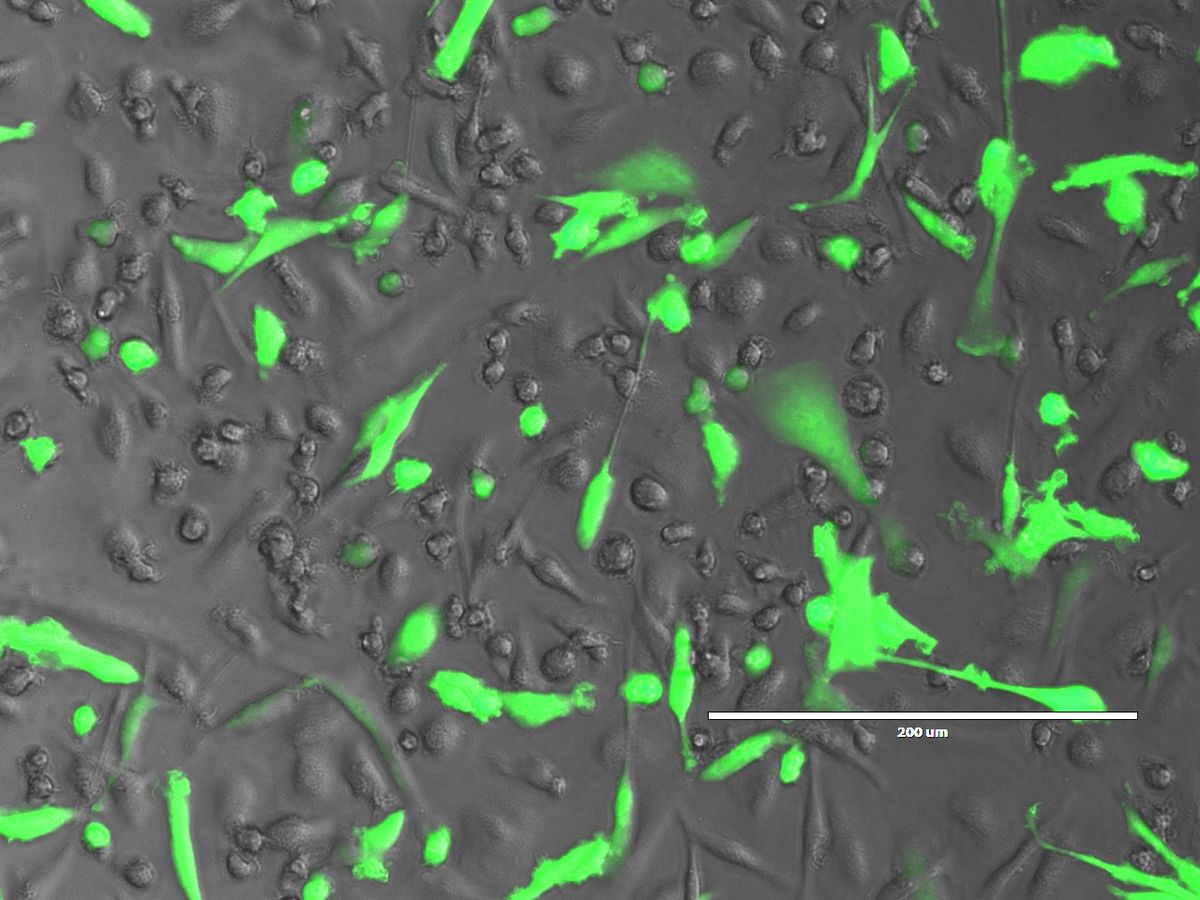 Photograph of green fluorescence, representing Marburg virus, in macrophages overlaid on a brightfield image of the cells in gray. Photograph of green fluorescence, representing Marburg virus, in macrophages overlaid on a brightfield image of the cells in gray.