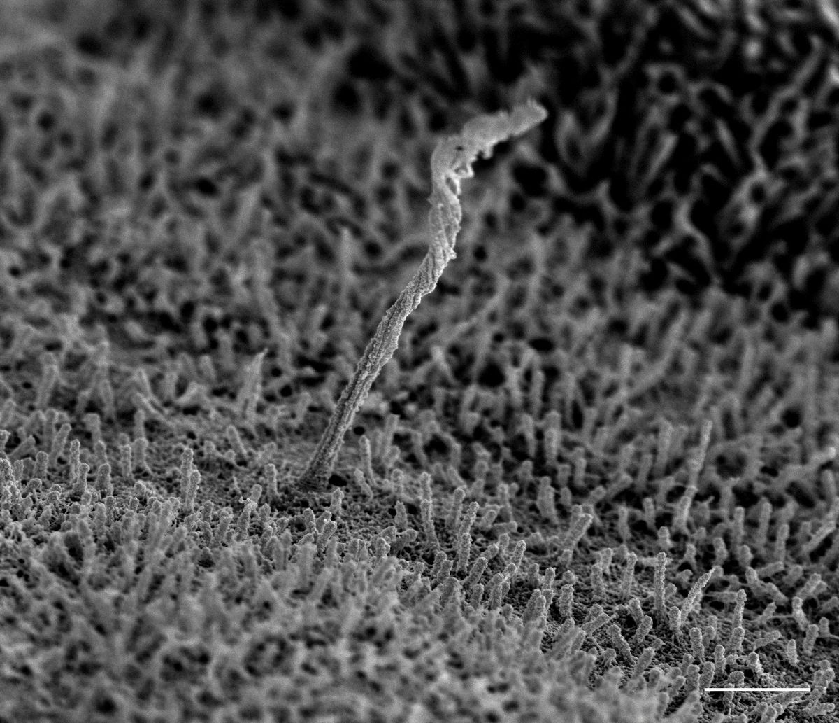 An antenna-like cellular structure emerges from the surface of a human pancreatic islet cell. The surface of the cell is covered with small structures called microvilli. An antenna-like cellular structure emerges from the surface of a human pancreatic islet cell. The surface of the cell is covered with small structures called microvilli.