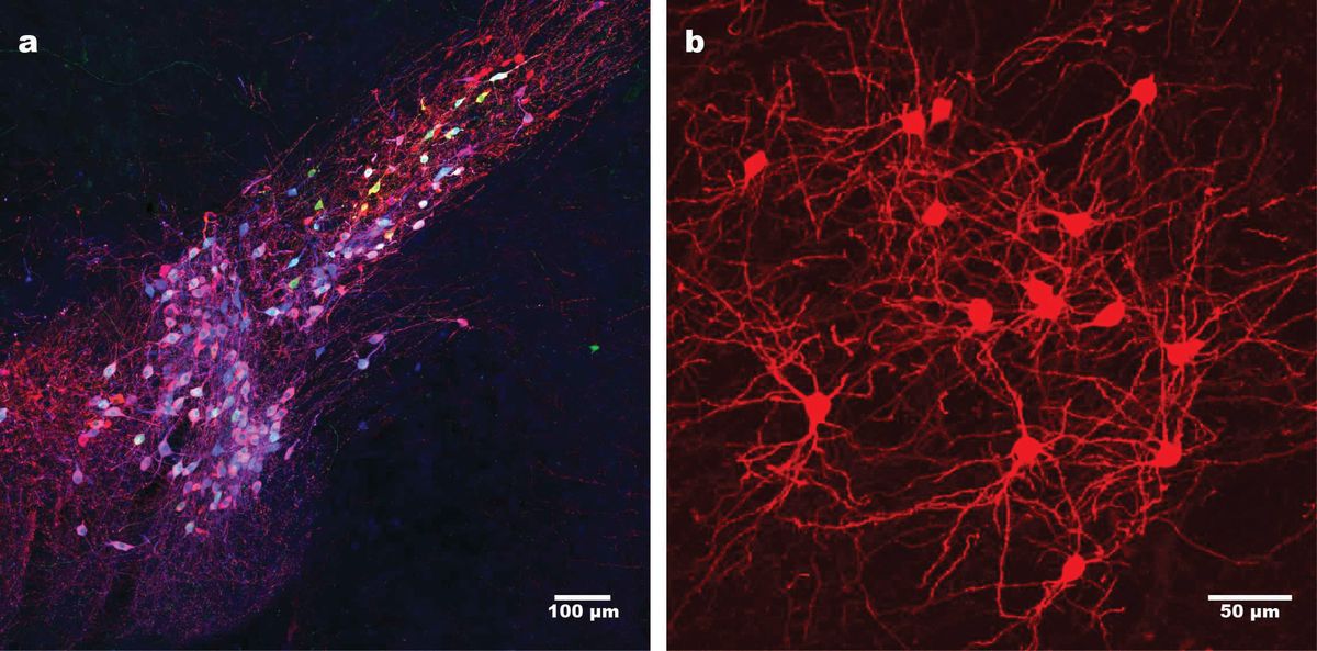 On the left, purple neurons in the mouse midbrain, on the right, a closer view of the neurons in red, showing long-term survival of infected neurons. On the left, purple neurons in the mouse midbrain, on the right, a closer view of the neurons in red, showing long-term survival of infected neurons.