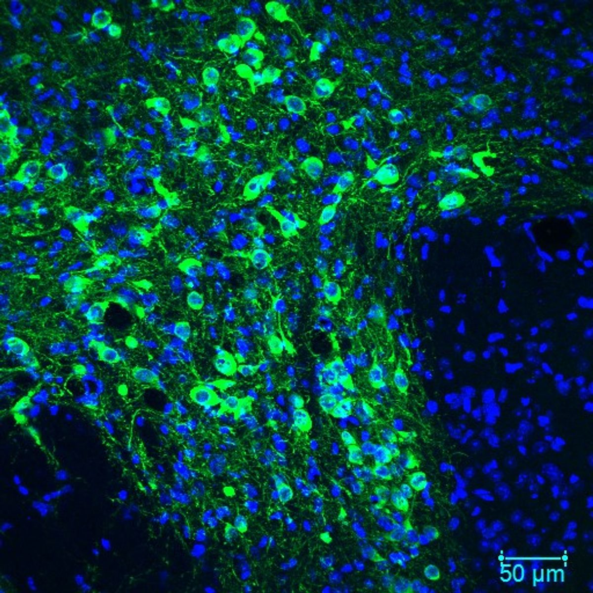 Cell bodies of dopamine neurons are stained green. Cell bodies of dopamine neurons are stained green.