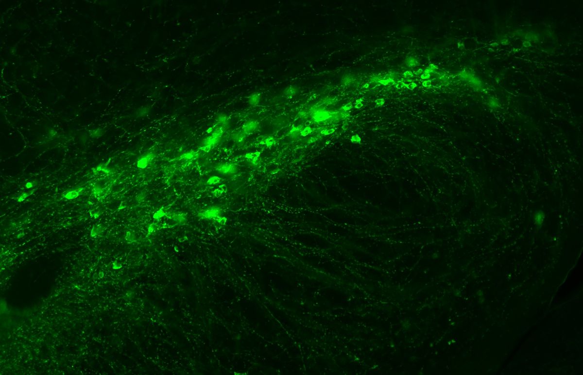 Dopamine neurons are stained green. Dopamine neurons are stained green.