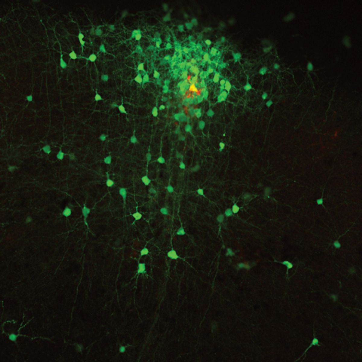 A single yellow neuron surrounded by many green neurons. A single yellow neuron surrounded by many green neurons.