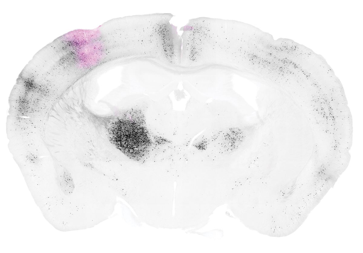 A coronal section of the mouse brain with an area of cortex in pink and black cell bodies in areas across the brain. A coronal section of the mouse brain with an area of cortex in pink and black cell bodies in areas across the brain.