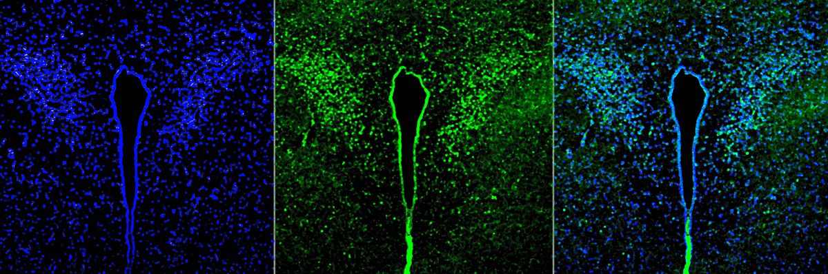 A three-panel image of a mouse brain after a lung infection with Pseudomonas that do not form biofilm. The left panel shows the nuclei of the neurons in blue, the middle panel shows the activated neurons in green, and the right panel shows a merged image of the first two. A three-panel image of a mouse brain after a lung infection with Pseudomonas that do not form biofilm. The left panel shows the nuclei of the neurons in blue, the middle panel shows the activated neurons in green, and the right panel shows a merged image of the first two.
