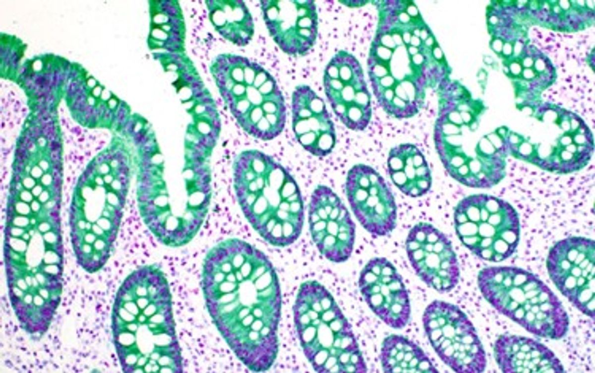 Double chromogenic IHC of normal colon tissue stained with antibodies to Bap1 (purple) and a cytokeratin cocktail (green) magnified 40X. Double chromogenic IHC of normal colon tissue stained with antibodies to Bap1 (purple) and a cytokeratin cocktail (green) magnified 40x.