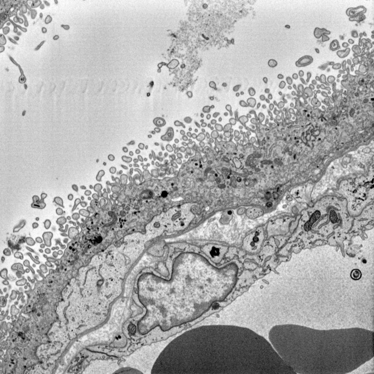 A black and white scanning electron microscopy image of cells within the placenta. A black and white scanning electron microscopy image of cells within the placenta.