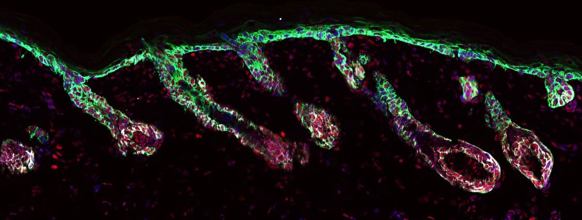 A microscopy image of fluorescently labeled cells in the hair follicles and the outer layer of the skin. A microscopy image of fluorescently labeled cells in the hair follicles and the outer layer of the skin.