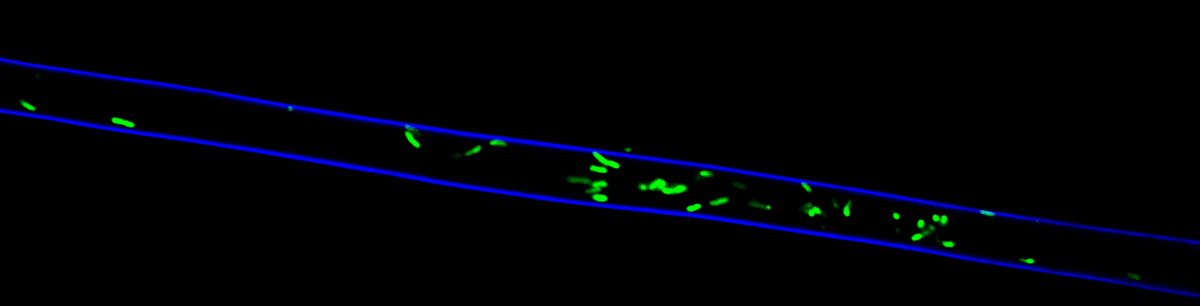 Fluorescent microscopy image of fungal walls labeled in blue with green-labeled bacteria inside. Fluorescent microscopy image of fungal walls labeled in blue with green-labeled bacteria inside.